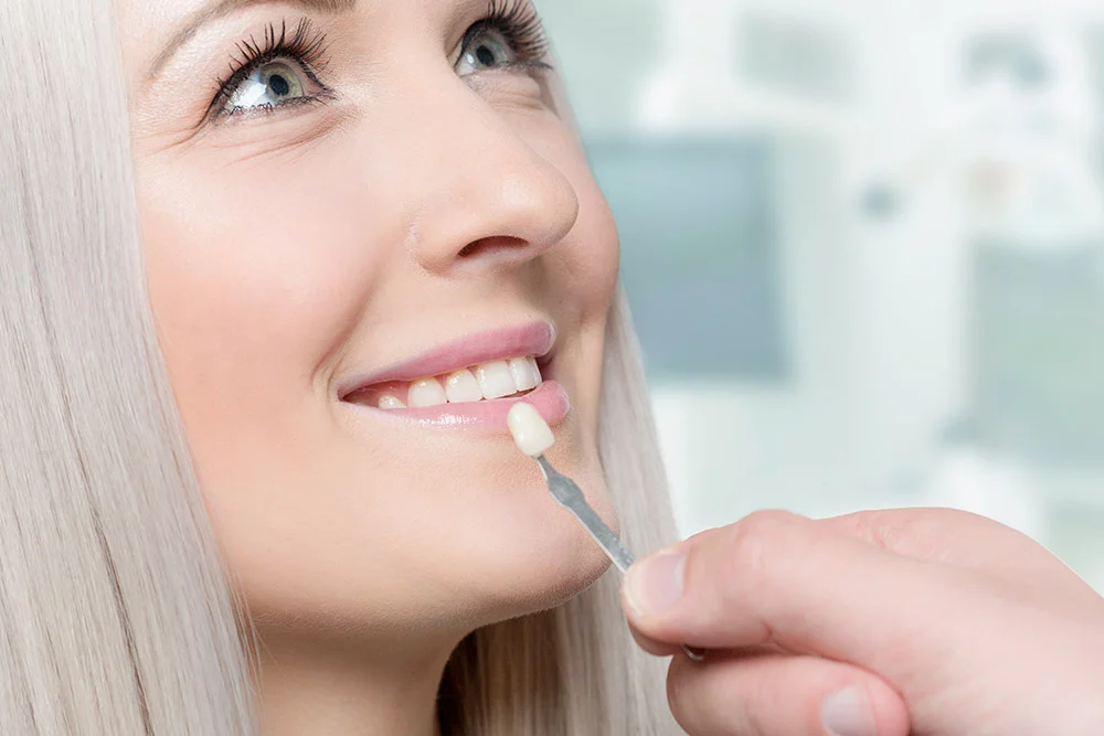 Smiling women showing Teeth Veneers in Dubai