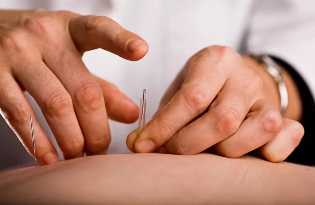 Benefits Involved With Acupuncture