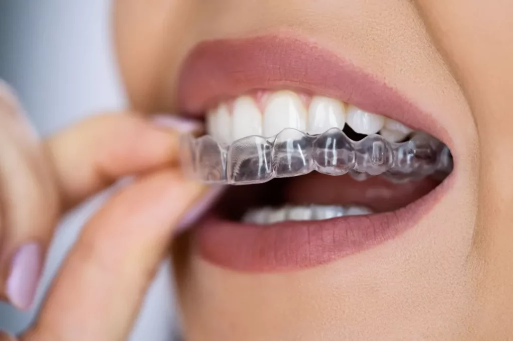 Can Orthodontists Do Filling?