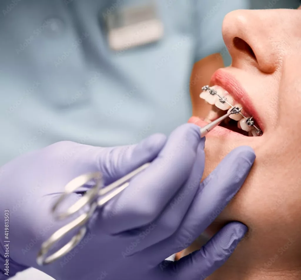 Dental Problems That Orthodontists Treat