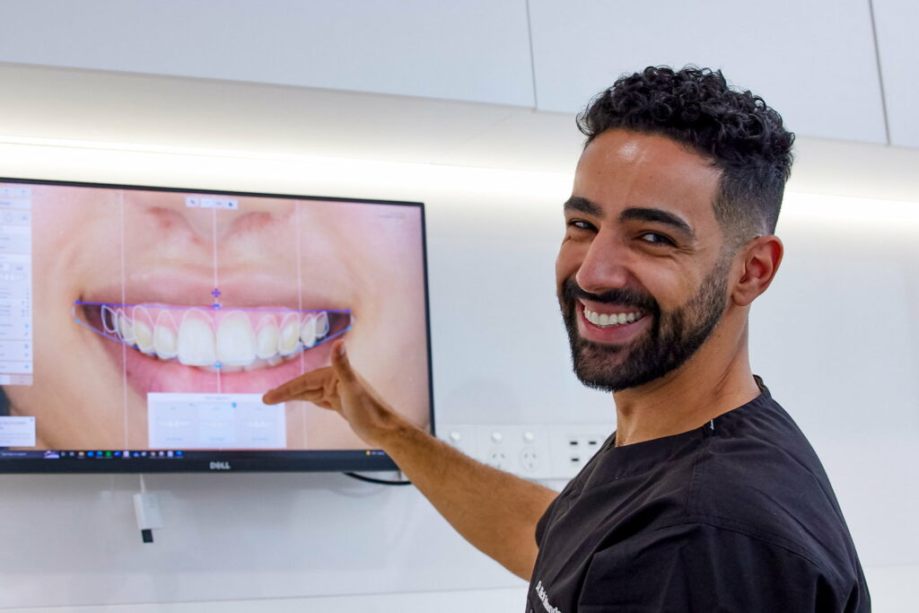 Image showing professional Porcelain veneers in Dubai