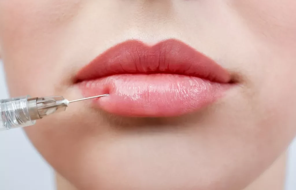 Ingredients In Dermal Fillers And How They Work​