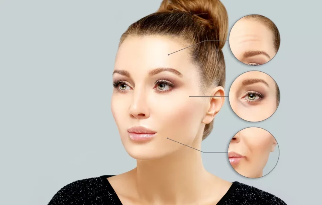 Mass Distribution And FDA-approved Fillers​ for dermal filler