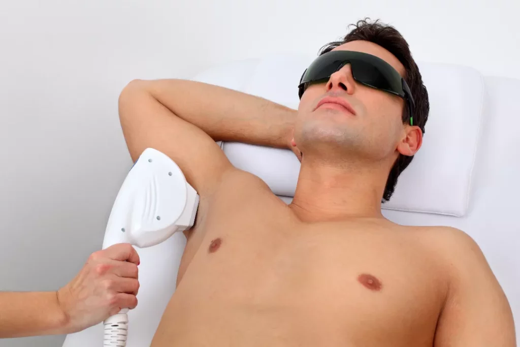 What Are The Factors That Affect The Duration Of Laser Hair Treatments?